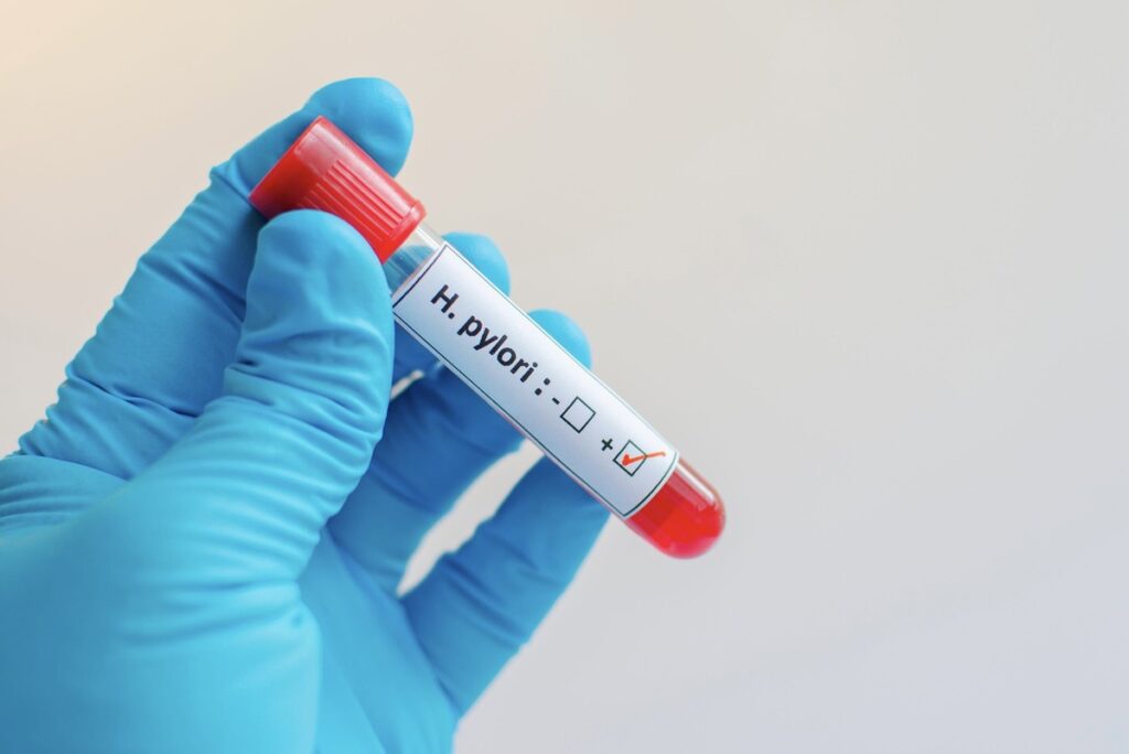 H. Pylori Diet: The Best Foods to Eat and Avoid for a Healthier Gut ...